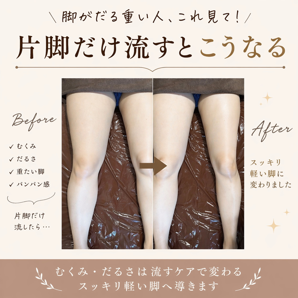 片脚だけに施術でここまで変わる｜ふくらはぎのむくみケア